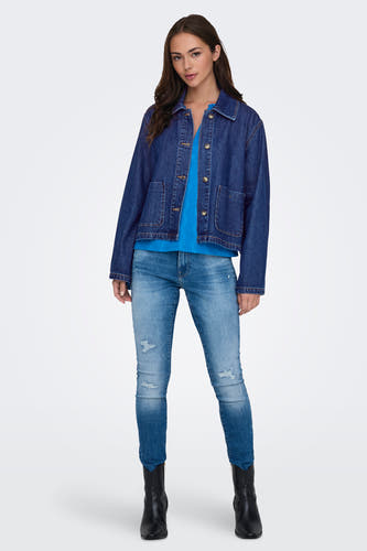 Jean de ONLY en denim bleu foncé, avec fermeture à boutons et poches brodées, porté avec une chemise bleue et des jeans destroyés.